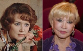 Новое лицо: Как пластика меняла судьбы советских актрис